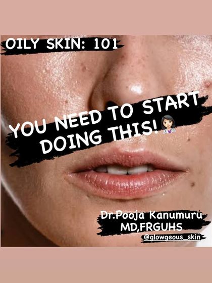 If you have oily skin, here are the five essential tips you need to start following. This includes cleansing twice daily, using a gel-based moisturizer, exfoliating weekly, wearing SPF, and avoiding heavy, greasy products to keep your skin balanced and clear.