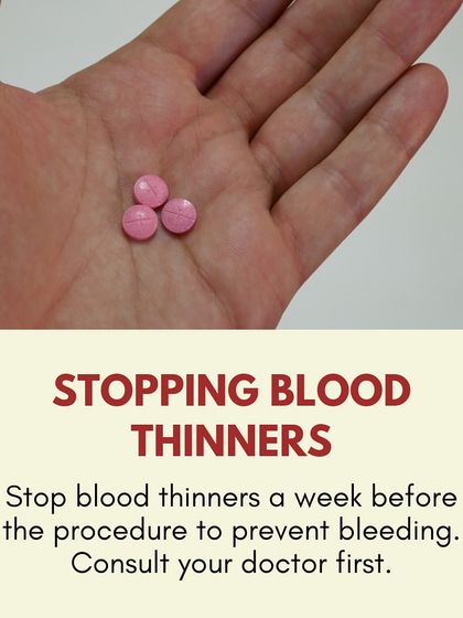 Pre-procedure care: If you are on blood thinners, you must consult your primary doctor about stopping them a week before the procedure to prevent excess bleeding.