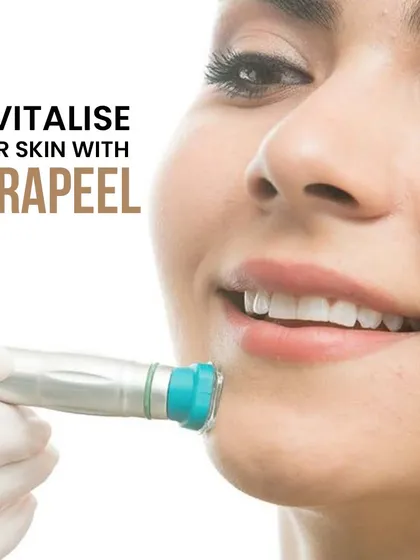Here you can see the MiraPeel device, a treatment designed to revitalize the skin. It is a gentle yet effective option for improving texture and tone, making it ideal for achieving a refreshed look before an important event or as part of a regular skin maintenance plan.