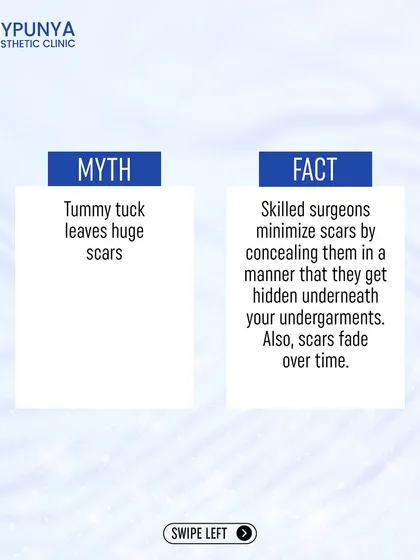 Myth: Tummy tucks leave huge scars. Fact: A skilled surgeon conceals the incision line so it can be hidden by undergarments, and the scar naturally fades over time.