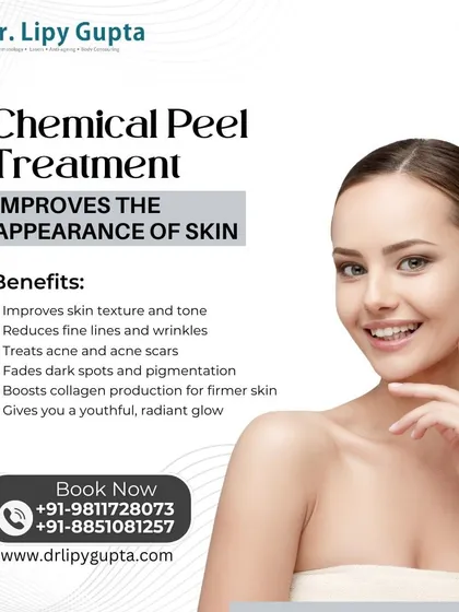 This graphic details the many benefits of a chemical peel. It improves skin texture and tone, reduces fine lines, treats acne and acne scars, fades dark spots, and boosts collagen for firmer skin. It is one of the most effective ways to achieve a youthful, radiant glow.