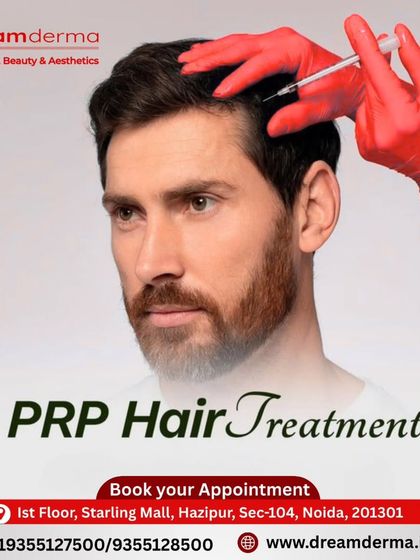 This image demonstrates the application of PRP hair treatment for men experiencing hair thinning. The procedure is precise and focuses on areas of concern to help restore hair density and strength.