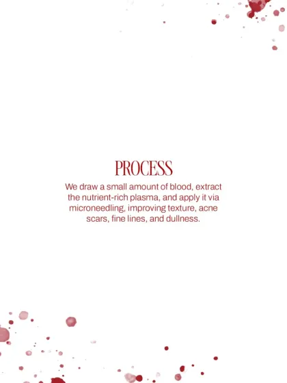 The PRP process is straightforward: I draw a small amount of blood, extract the nutrient-rich plasma, and apply it via microneedling to improve texture, acne scars, and dullness.