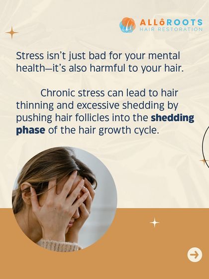 Stress isn't just bad for your mental health; it's also harmful to your hair. Chronic stress can push hair follicles directly into the shedding phase of the hair growth cycle, resulting in thinning and excessive hair fall.