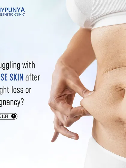 If you're dealing with loose skin after pregnancy or weight loss, a tummy tuck, or abdominoplasty, can be an effective solution to tighten and tone the area.