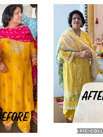 It is never too late to prioritize your health. This inspiring client was 70 years old and was told weight loss would be impossible. With consistent guidance and a sustainable diet plan, she lost 9 kgs in just three months, proving that age is just a number when you have the right support.