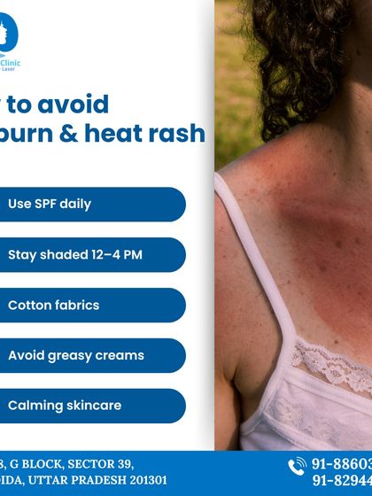 This guide shows you how to avoid sunburn and heat rash. Key steps include using SPF daily, staying shaded during peak sun hours, and wearing breathable cotton fabrics.