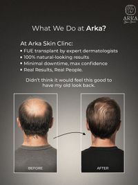 Hair Restoration & Scalp Treatments