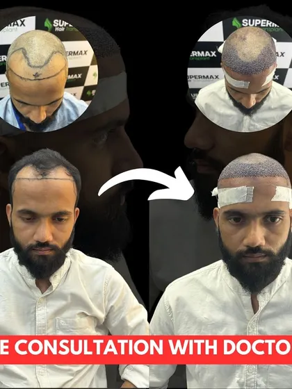 Get a free consultation with our doctor. This collage shows the journey from consultation to the final result.