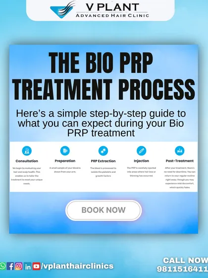 The Bio PRP treatment process is simple and effective. This guide shows our step by step approach, from consultation and PRP extraction to the final injection, ensuring you know exactly what to expect during your biotin-infused hair growth therapy.