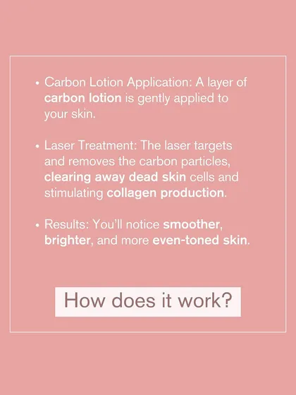 Here is how the Carbon Laser Peel works. A layer of carbon lotion is applied, and the laser targets these particles to clear away dead skin cells and stimulate collagen, resulting in brighter skin.