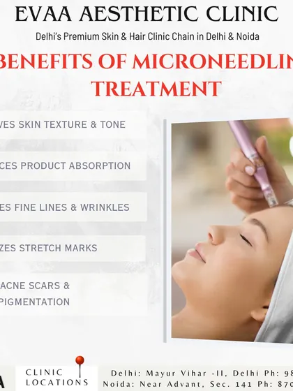 Discover the benefits of Microneedling, including improved skin texture, enhanced product absorption, reduced fine lines, and faded acne scars and hyperpigmentation.