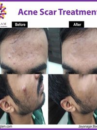 Advanced Skincare Treatments