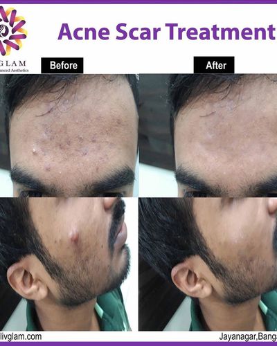 Advanced Skincare Treatments