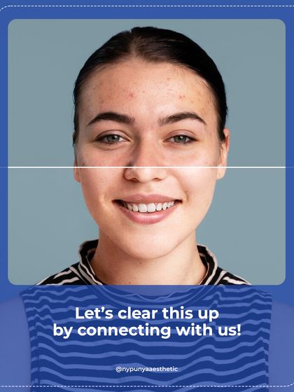 A side-by-side comparison showing the journey from active breakouts to clear, healthy skin. Let's work together to clear this up and restore your confidence.