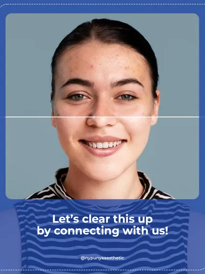 A side-by-side comparison showing the journey from active breakouts to clear, healthy skin. Let's work together to clear this up and restore your confidence.