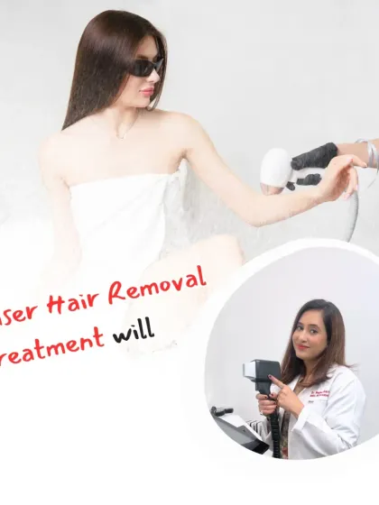 This image illustrates a typical laser hair removal session. The procedure is performed by a trained professional to ensure safety and effectiveness, helping you achieve the smooth, hair-free skin you desire.