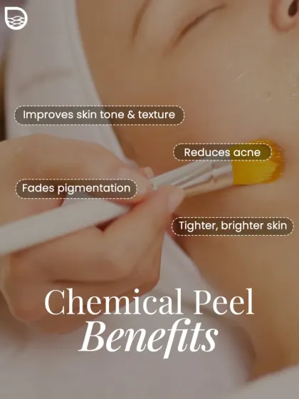 A chemical peel is a powerful tool for skin renewal, as shown in this treatment application. I use specific formulations to improve skin tone and texture, reduce active acne, fade post-inflammatory pigmentation, and reveal tighter, brighter skin.