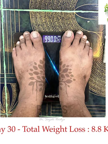 Just 30 days later, the same client weighed in at 99.0 kgs. This shows a total weight loss of 8.8 kgs in one month, achieved naturally without any extreme diets or supplements.