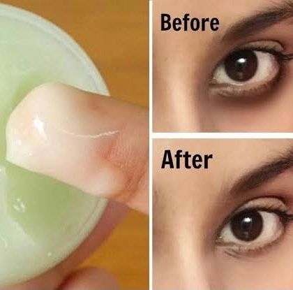 Here's another look at the amazing results from my Magical Under Eye Cream. It's formulated with gentle, natural ingredients to diminish fine lines and promote collagen.