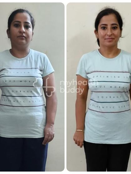 A front view of Surabhi's amazing progress. She proves that with the right lifestyle changes, you can effectively manage health conditions like thyroid issues.
