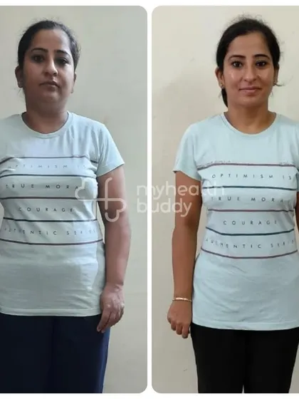 A front view of Surabhi's amazing progress. She proves that with the right lifestyle changes, you can effectively manage health conditions like thyroid issues.
