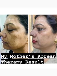 Advanced Skincare Treatments