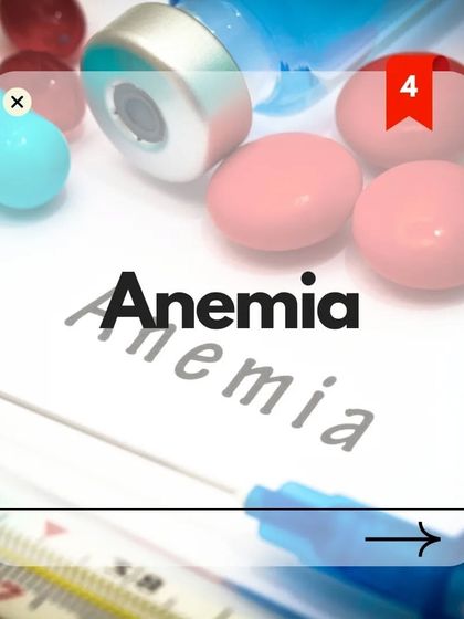 Anemia, or iron deficiency, can lead to hair loss because iron is essential for producing hemoglobin, which carries oxygen for the growth and repair of cells, including those that stimulate hair growth.