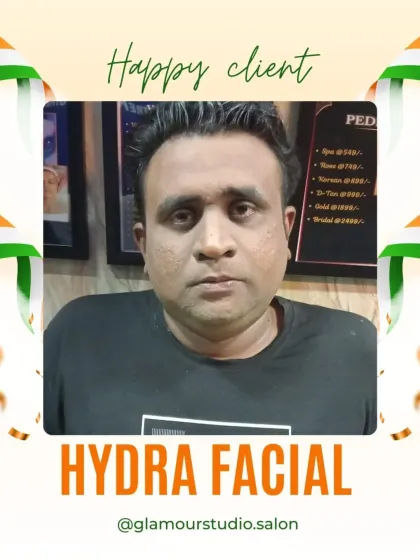 A satisfied client looking confident after his Hydra Facial. Our treatments are designed for everyone.