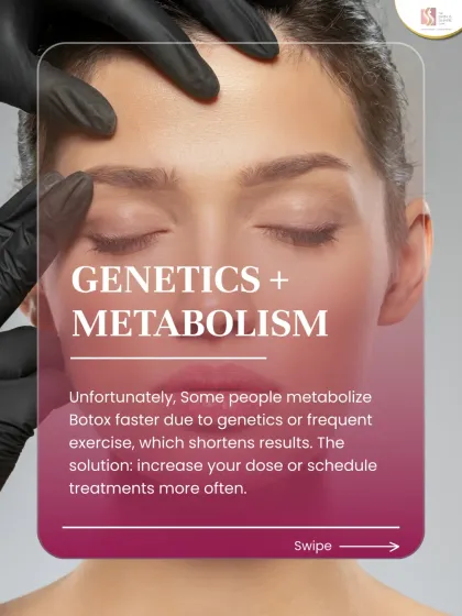 Genetics and a fast metabolism can cause some people to process Botox more quickly. In these cases, we may need to adjust the dose or treatment frequency.