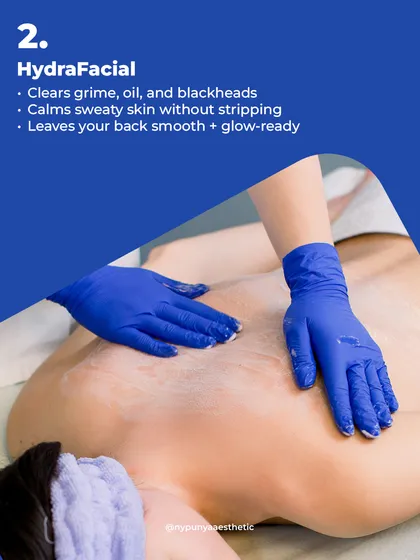 A HydraFacial for the back is another great option. It deeply cleanses and clears out grime, oil, and blackheads without stripping the skin, leaving your back smooth and ready to be shown off.