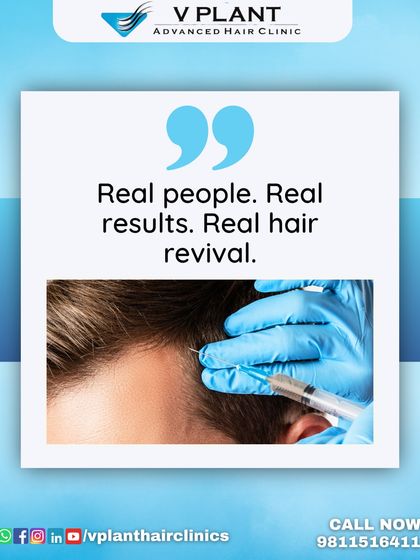 Real people, real results, real hair revival. This is the core of what we do. We focus on providing treatments that deliver genuine, visible improvements in hair health and density.