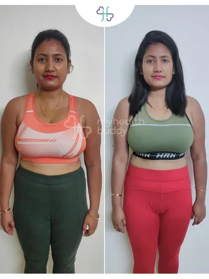 Front view of Sangita's 5kg transformation.