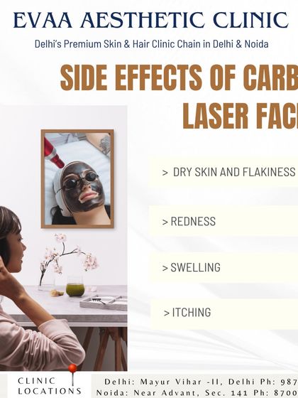 We believe in transparency. This graphic informs clients about potential temporary side effects of a Carbon Laser Facial, such as redness or dryness, which are typically mild and short-lived.