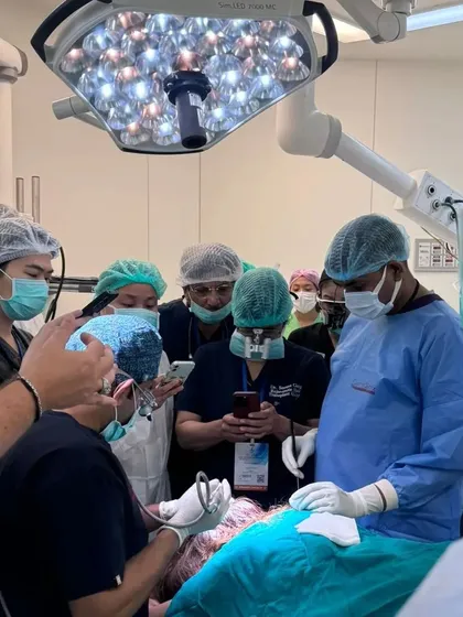 Another angle from our live surgery demonstration in Bangkok. Notice the use of high-magnification loupes, a standard I instill for precision work in FUE surgery.