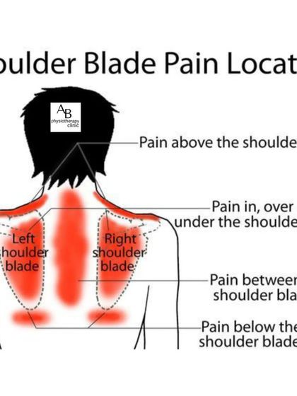 Pain around the shoulder blade can have many sources. This diagram shows the different pain locations and what they might indicate, from muscle strain to issues with internal organs, highlighting the importance of a proper diagnosis.
