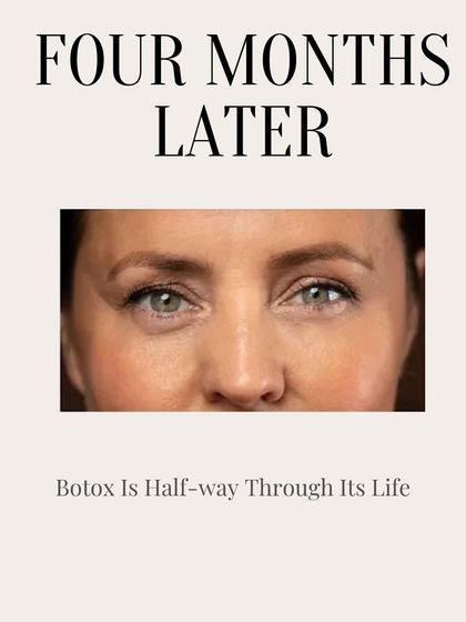 Clinic Next Face - Cosmetic Injectables Botox Treatments: Smooth Wrinkles & Refine Contours photo 11