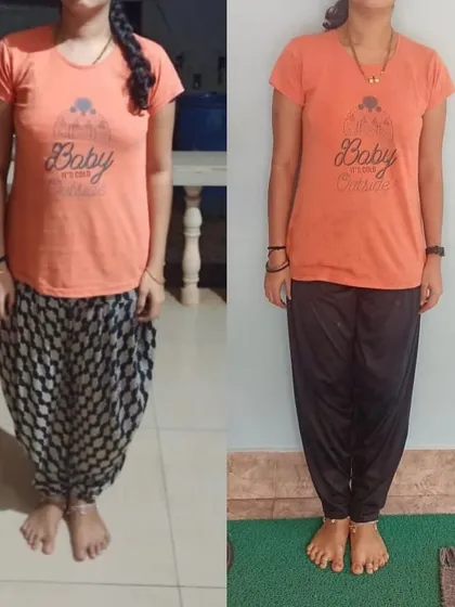 A before and after of the same breastfeeding mom. Her main concern was lower back pain, which was resolved through core rehab and fat loss. Her transformation is visible and inspiring.