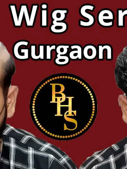Another successful hair wig service in Gurgaon. We covered the client's baldness completely, giving him a dense and stylish look that matches his face.