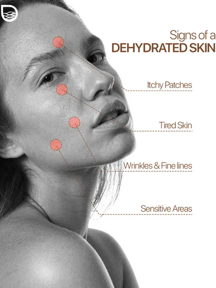 This diagram points out the key signs of dehydrated skin, which include itchy patches, a tired appearance, fine lines, and sensitive areas.
