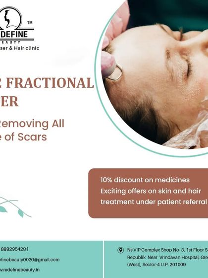 This graphic highlights the CO2 Fractional Laser as a powerful solution for removing all types of scars. We use this technology to help clients achieve smoother, clearer skin.