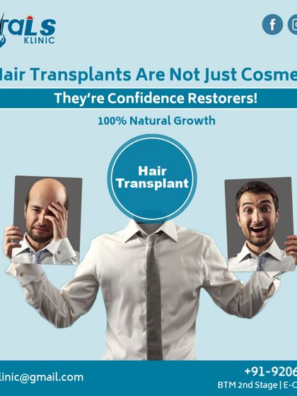 Vitals Klinic - Hair Restoration & Treatment FUE Hair Transplantation: A Permanent Solution photo 9