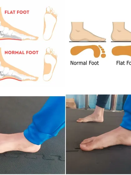 My coaching goes beyond standard fitness. Here you can see an example of how we use targeted corrective exercises to help students with issues like flat feet. Proper guidance can significantly improve foot health and prevent future problems, reflecting my commitment to your overall well-being.
