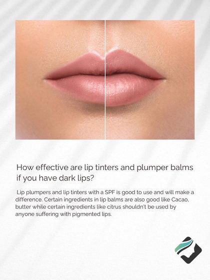 While lip balms with SPF can help, they may not be enough for pigmented lips. We provide consultations to determine the most effective treatment for your specific concern.