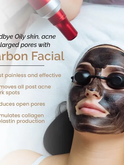 The Carbon Laser Peel is an effective solution for persistent oily skin, acne, and enlarged pores. This image shows the treatment in progress, which uses a carbon mask and laser to remove dark spots, reduce pore size, and stimulate collagen for lasting results.