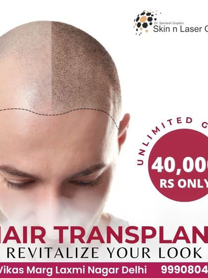 We offer hair transplant packages that provide unlimited grafts for a fixed price, ensuring full coverage for areas of significant baldness without any hidden costs.