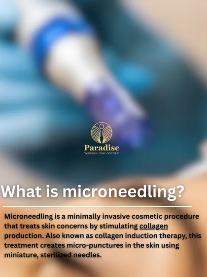 What is microneedling? It's a minimally invasive procedure that treats skin concerns by stimulating collagen production. I use miniature, sterilized needles to create micro-punctures that encourage skin renewal.