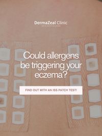 Allergy Patch Testing