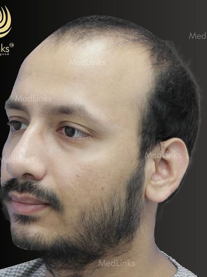 Another 'before' angle from the side.