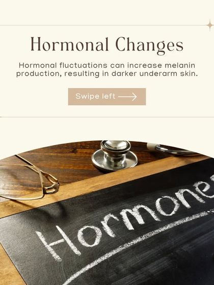 Hormonal fluctuations, common in conditions like PCOS or thyroid disorders, can increase melanin production and cause skin darkening. Our consultations help identify and manage these hormonal triggers.